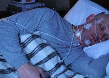El truco de la almohada para mejorar la apnea del sueño