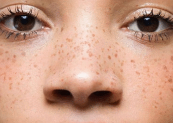 El maquillaje con pecas falsas que rejuvenecen 5 años