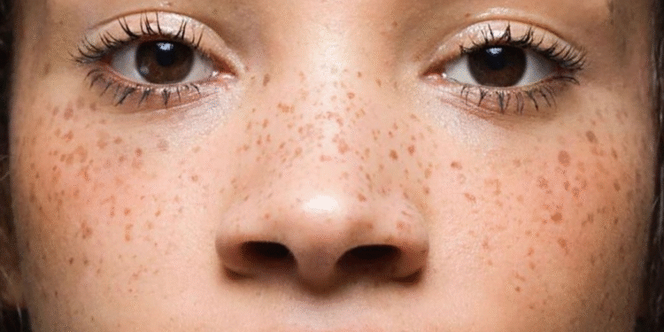El maquillaje con pecas falsas que rejuvenecen 5 años
