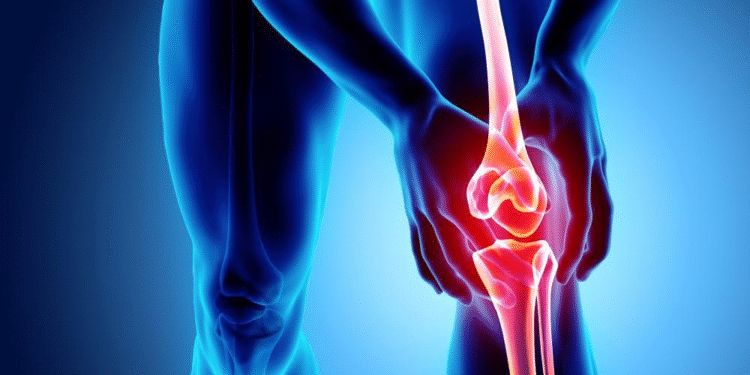 Ejercicio clave para reducir los dolores de rodilla