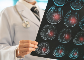 Estas son las bebidas más nocivas para el riesgo de accidente cerebrovascular