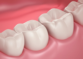 Científicos crean innovadora tecnología para reparar el esmalte dental