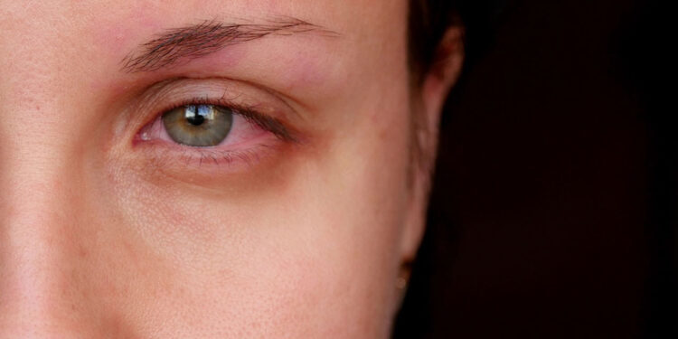 Dor nos olhos e na cabeça ao mesmo tempo: o que pode ser?