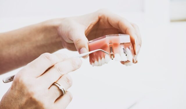 Talvez o seu próximo implante dentário seja de material feito com ‘xixi’