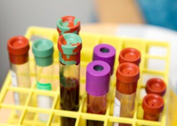 Cientistas revelam a descoberta de um novo grupo sanguíneo