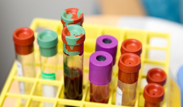 Cientistas revelam a descoberta de um novo grupo sanguíneo