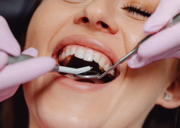 Problema de saúde comum é o que mais faz pessoas perderem dentes no Brasil