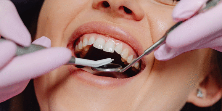 Problema de saúde comum é o que mais faz pessoas perderem dentes no Brasil