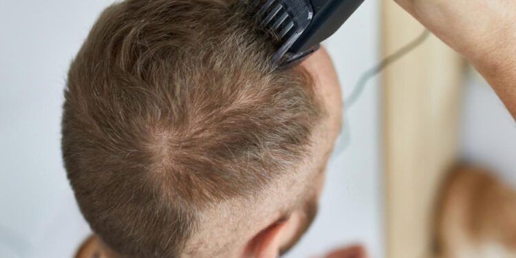 6 cortes de cabelo para homens acima de 40 anos parecerem mais jovens