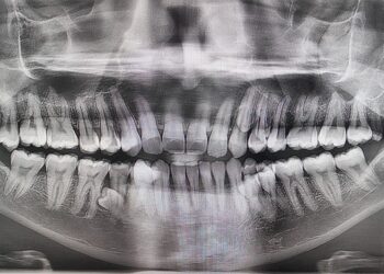Homem achava ter 38 dentes, foram encontrados mais 4 e ele entrou para o Guinness Book