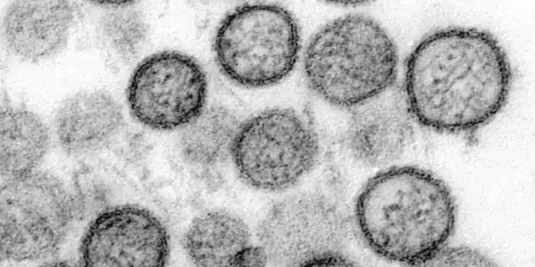 Vírus que vem assustando as Américas não há vacina para prevenir e nem cura